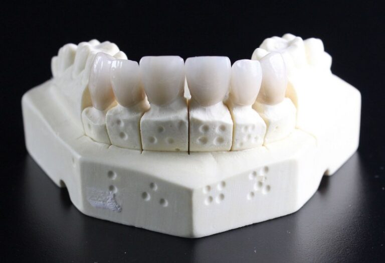 Sognare di Perdere i Denti: significato e simboli nascosti